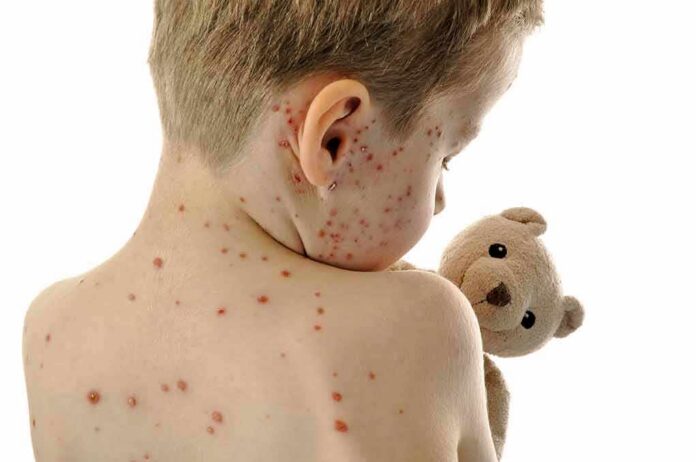 Child with red spots on back holding a teddy bear