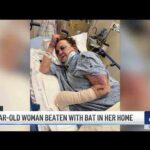 Crestline woman brutally beaten with baseball bat after helping stranger